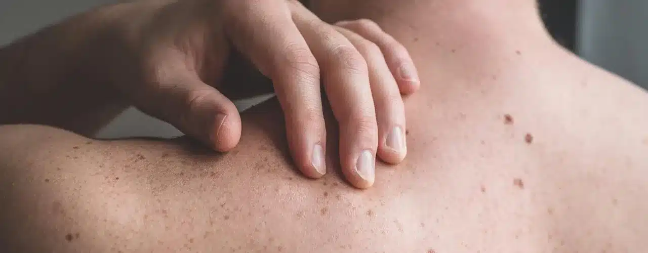 Skin-Lesions-&-Skin--Conditions-Treatment---Tahir-Surgical-Center---Gilbert-Arizona Common skin symptoms and conditions - Tahir Surgical Clinic